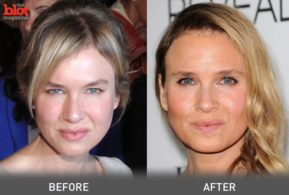Renee Zellweger’s recent appearance caused a catty firestorm on the Interne...