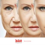 Photo Aging, What is it and How to Combat it