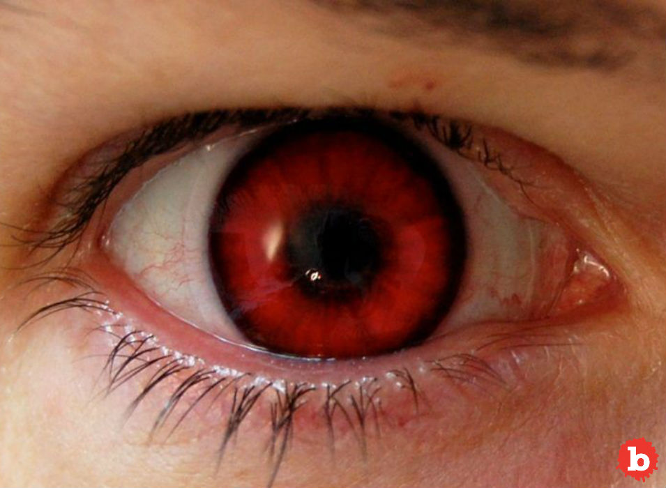 Man Overdosed on Viagra, Gets Permanently Red Tinged Vision