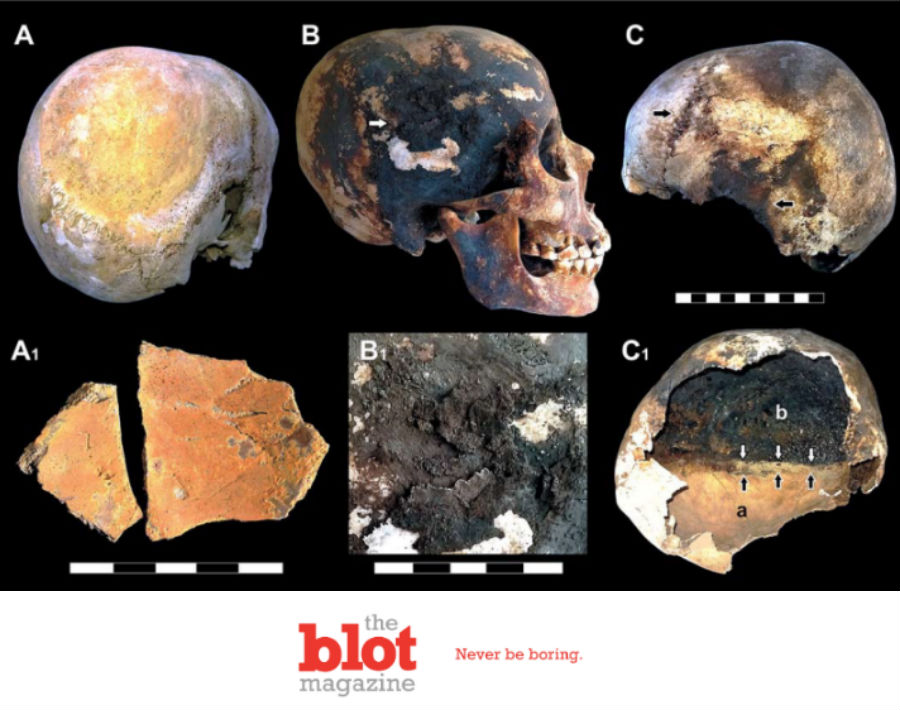 New Findings Show Ancient Vesuvius Eruption Exploded Skulls