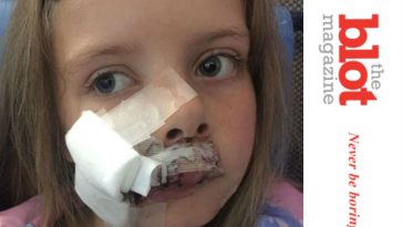 Labrador Attacks 9-Year-Old Girl, 230 Stitches of Damage