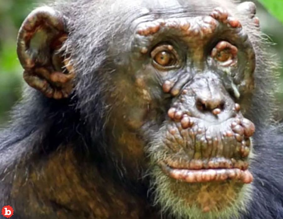 Wild Chimpanzees Have Leprosy in West Africa?