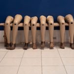 Austrian Surgeon Amputates Patient’s Wrong Leg, Only Gets $3,000 Fine