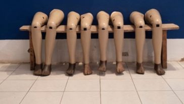 Austrian Surgeon Amputates Patient’s Wrong Leg, Only Gets $3,000 Fine